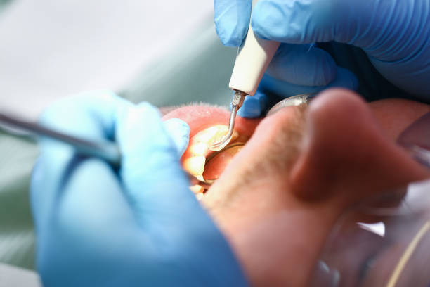 Best Emergency Treatment for Dental Infections or Abscesses in Keyes, CA